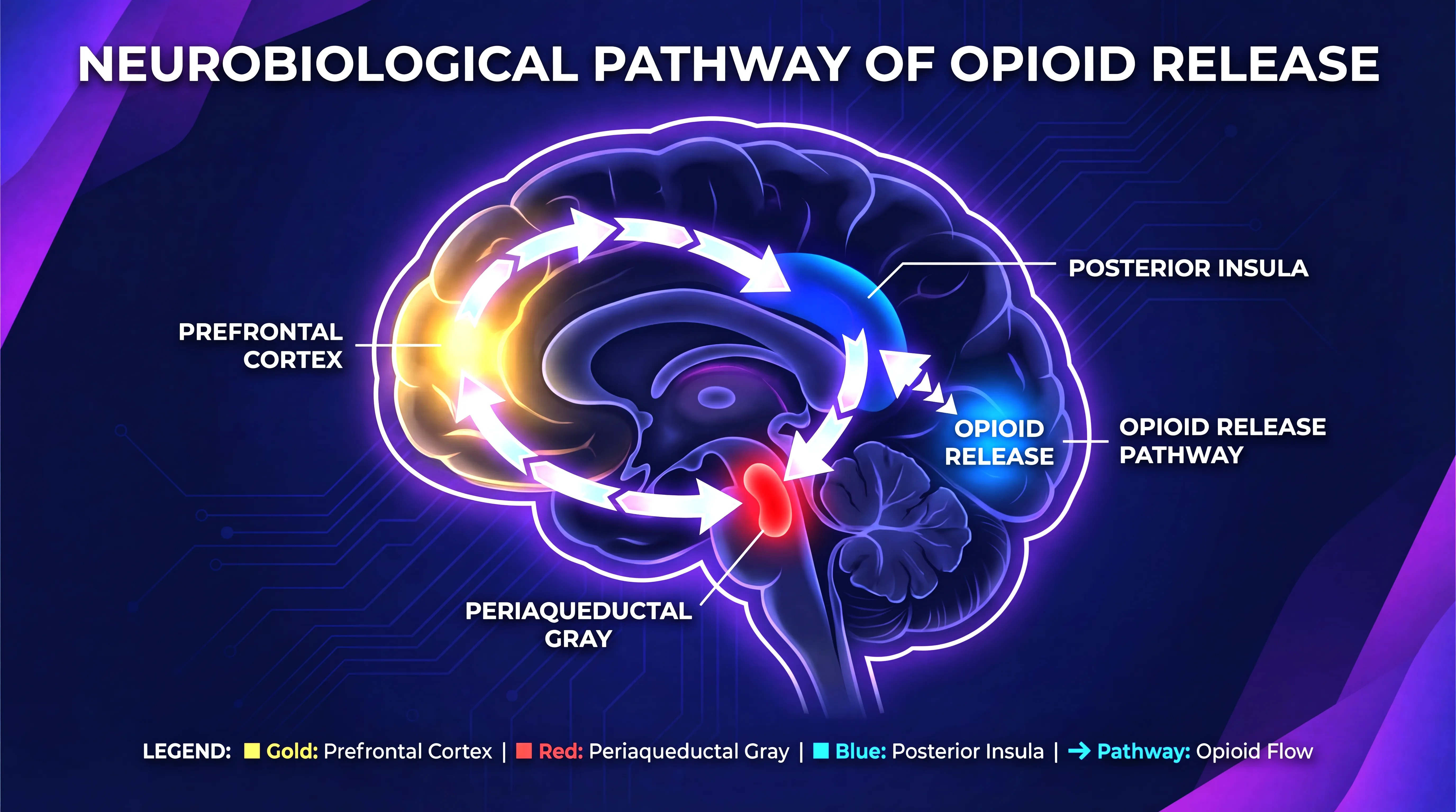 Brain mechanisms of the placebo effect