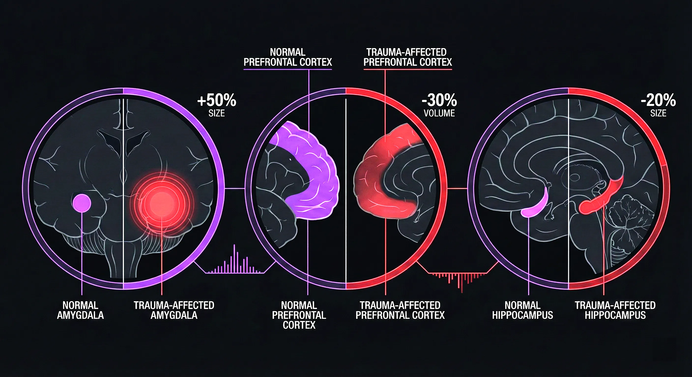 Three brain regions affected by trauma