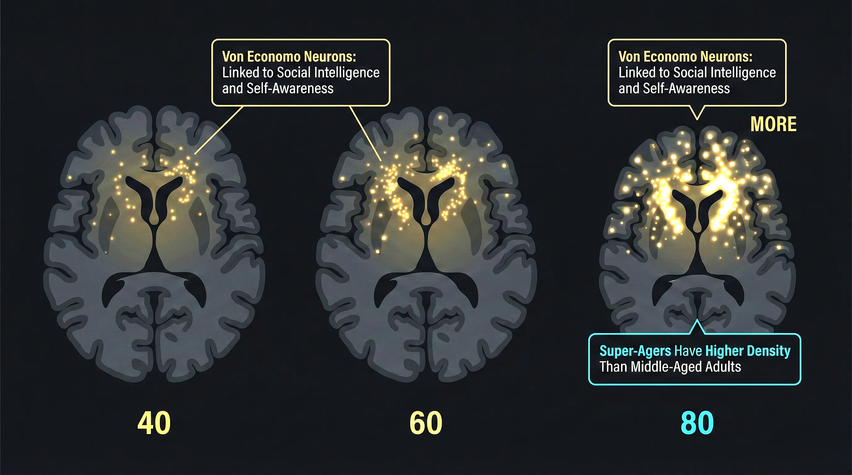 Brain compensation mechanisms in aging